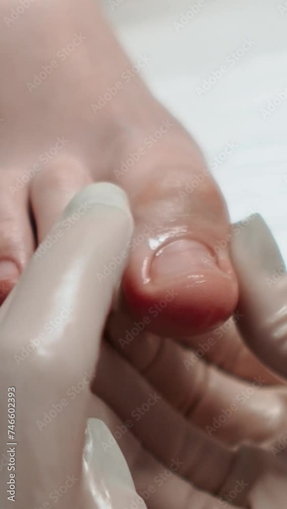 A pedicure master does cleaning and massage, pedicure, to a young beautiful girl with a small foot. Caring for female beauty in a beauty salon during a procedure. Skin of feet and toes close-up A pedicure master does cleaning and massage, pedicure, to a young beautiful girl with a small foot. Caring for female beauty in a beauty salon during a procedure. Skin of feet and toes close-up