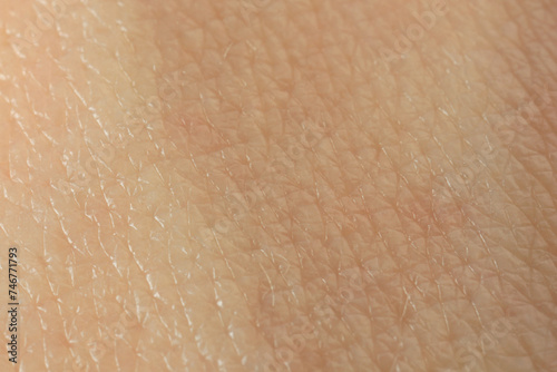 Texture of dry skin as background, macro view photo