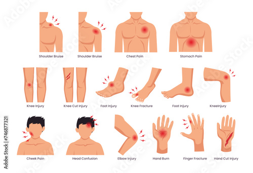 Set of physical injury set collection, Cartoon physical injury, wound bandage application, bandaged human body parts, treated wounds, fractures treatment, Hurt and injury, vector illustration. photo
