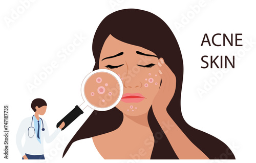 Dermatologist checking young woman face with skin acne, pimples, blackheads vector illustration. Acne skin face problem concept
