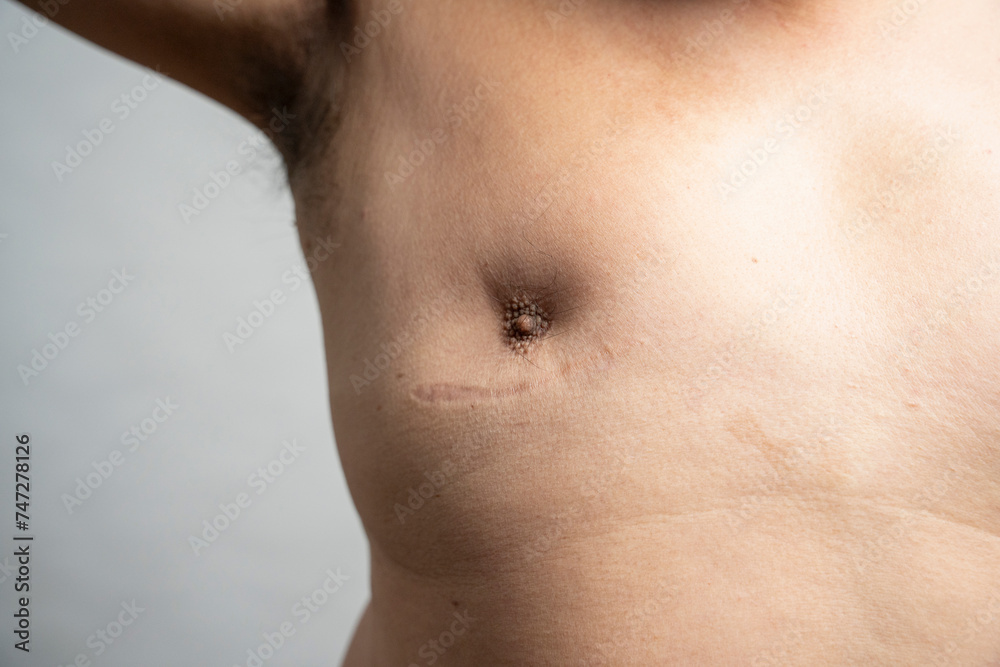 Close-up of man chest with nipple and scar against gray background Close-up of man chest with nipple and scar against gray background