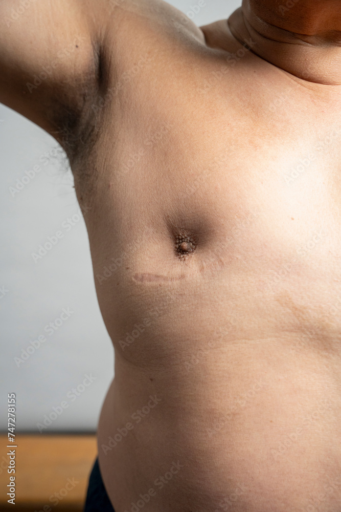 Close-up of man chest with nipple and scar against gray background