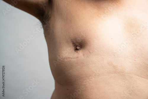 Close-up of man chest with nipple and scar against gray background