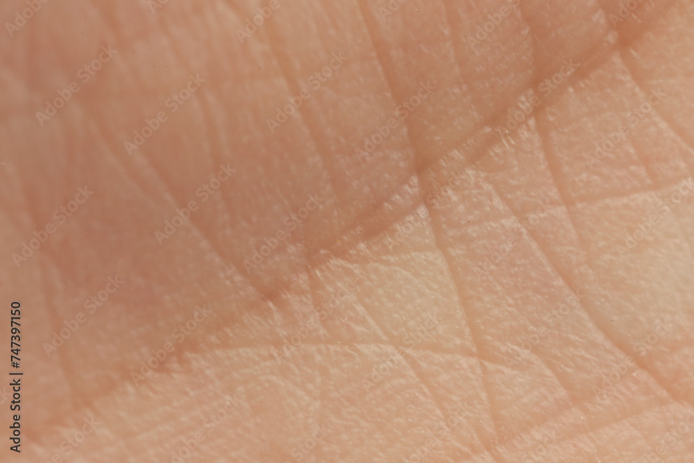 Texture of dry skin as background, macro view Texture of dry skin as background, macro view