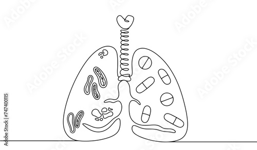 Virus. Tuberculosis. Medicine. Treatment. Disease