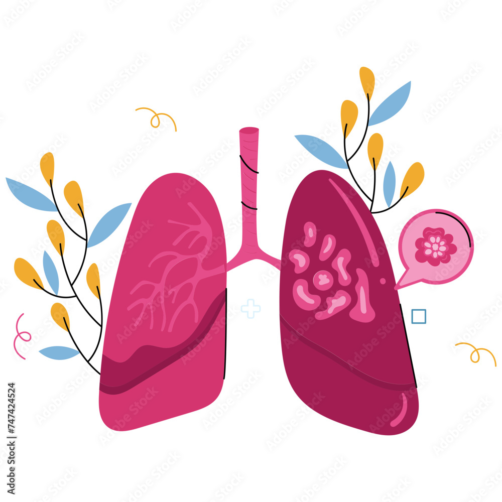 Sick Lungs World Tuberculosis Day 2D Illustrations Sick Lungs World Tuberculosis Day 2D Illustrations
