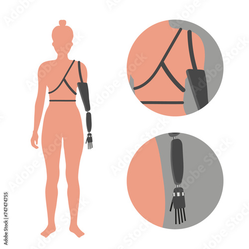 Disabled woman wearing innovative exoskeleton