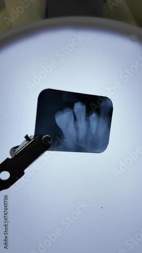 odonto raio x dental photo