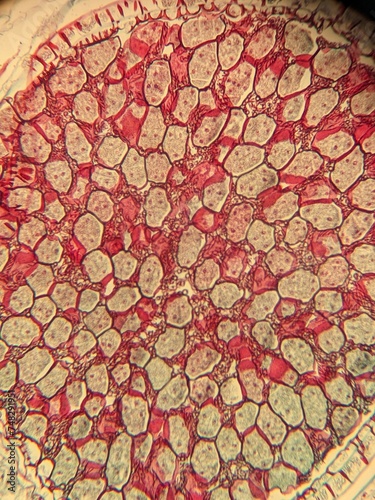 Foto The Sporophyte of Pellia tissue under the microscope