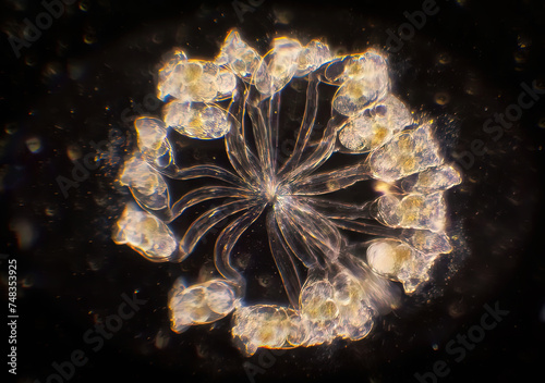 Cluster of Vorticella