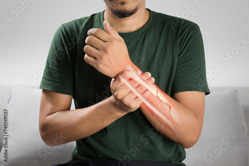 Tableau sur toile Broken forearm bone