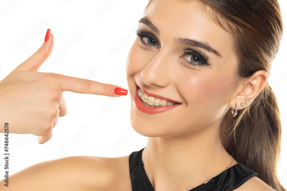 Face of a young smiling beautiful brunette woman pointing on the braces on her teeth, Face of a young smiling beautiful brunette woman pointing on the braces on her teeth,