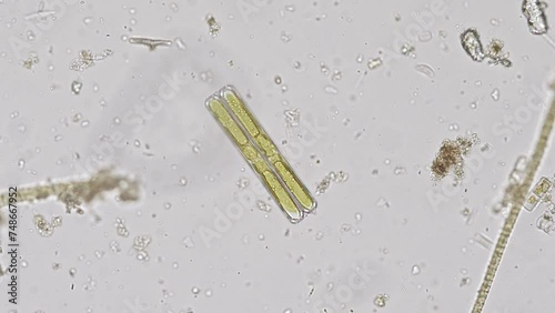 Pinnularia diatom algae under the microscope - optical microscope x200 magnification photo