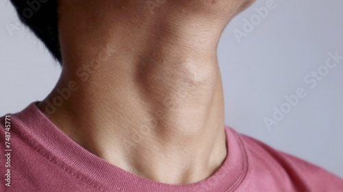 Photo of a man's Adam's apple and neck area protruding against