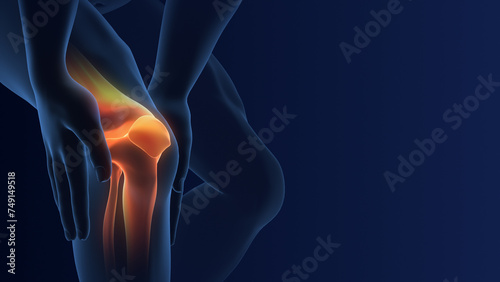 Medical Concept of Knee joint pain
