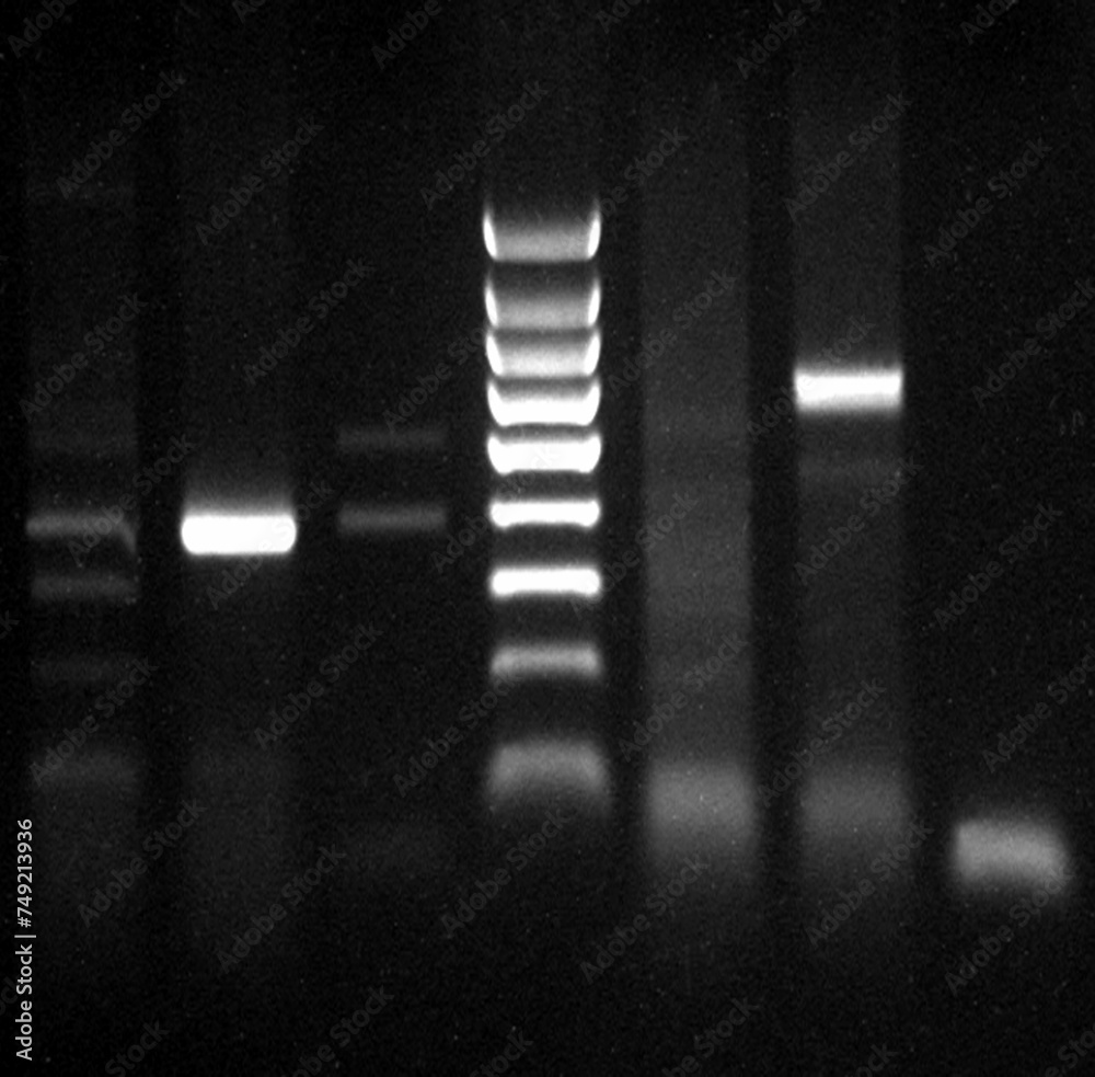 DNA fragment visualised on an Ethidium Bromide Agarose gel
