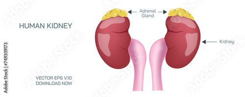 Kidney vector art. Chronic kidney disease, also called chronic kidney failure, involves a gradual loss of kidney function. Your kidneys can't filter wastes and excess fluids. Vector illustration.