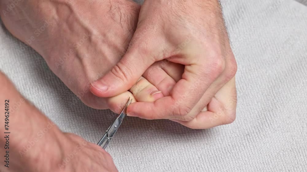 Man cutting toenails with scissors. Male cut toenails on foot. Foot care. Man cutting toenails with scissors. Male cut toenails on foot. Foot care.