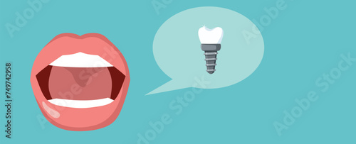 
Mouth with Dental Implant Vector Cartoon Illustration
Healthy person having a new artificial tooth as replacement treatment 
