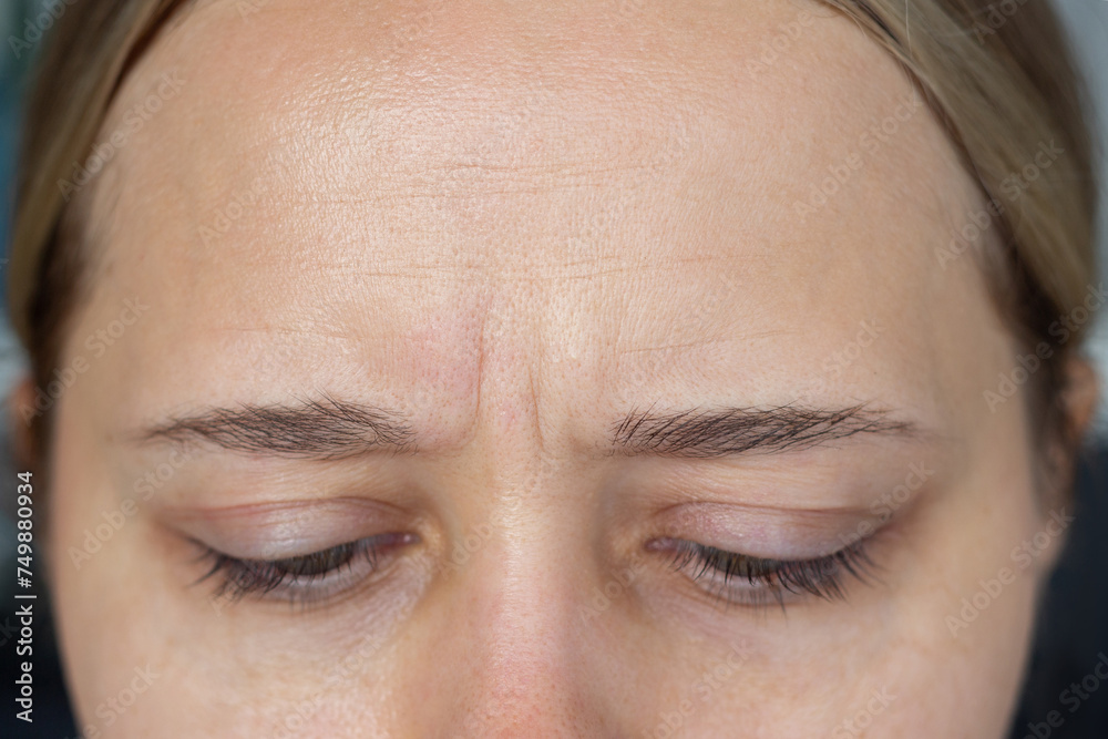 Obraz premium Young caucasian woman with wrinkles on her forehead. Wrinkling the face. Skin care. Beauty concept
