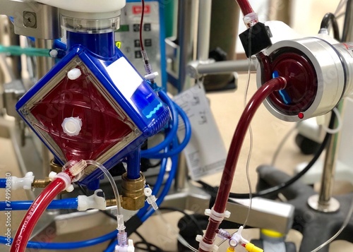  ECMO (Extracorporeal membrane oxygenation) in critical care unit (CCU) photo