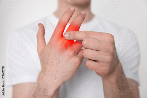Man suffering from rheumatism on light background, closeup