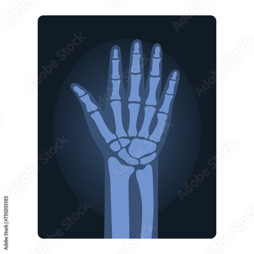 Xray shot of human hand. Medical injury test, body radiography cartoon vector illustration