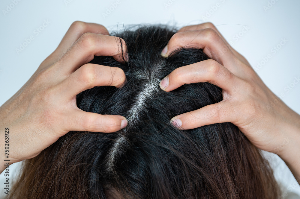 Cropped shot view of Asian woman scratching her scalp. Cropped shot view of Asian woman scratching her scalp.