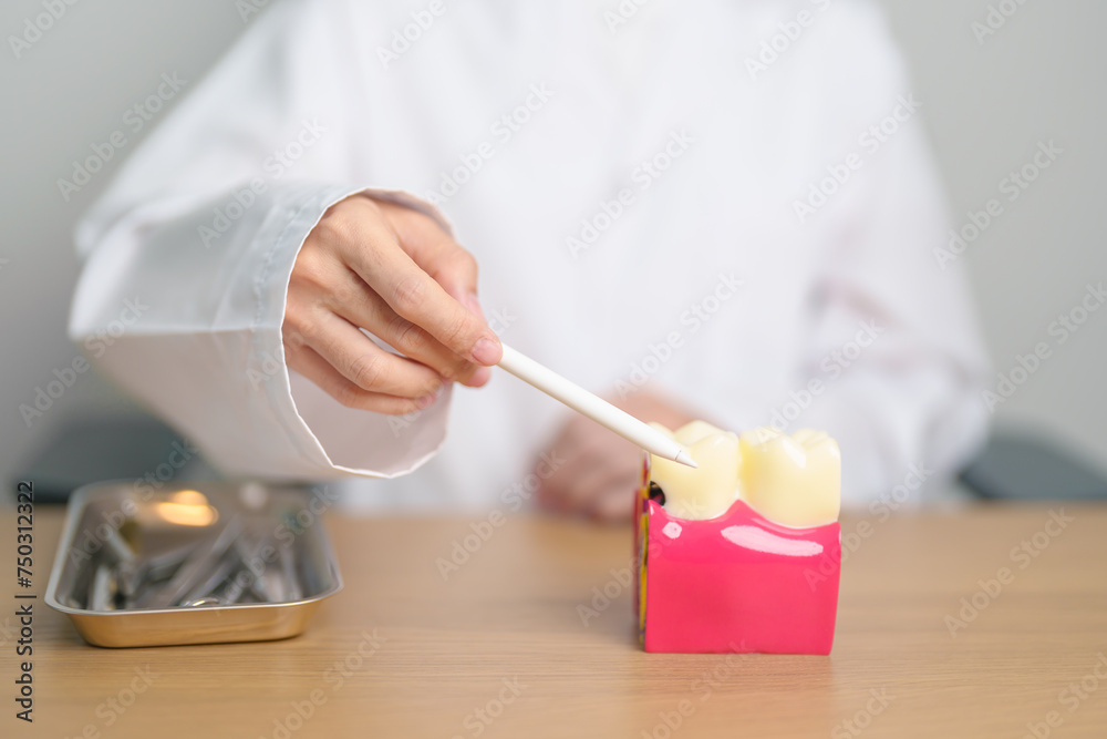 Dentist with tooth Anatomy model. Oral Teeth decay and disease, Scrape off tartar. March Oral