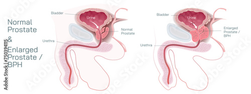The prostate gland is located just below the bladder in men and surrounds the top portion of the tube that drains urine from the bladder or urethra vector illustration. Students study material.