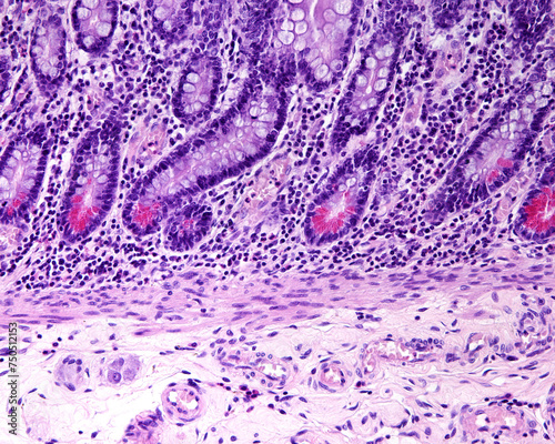 Small intestine. Paneth cells photo