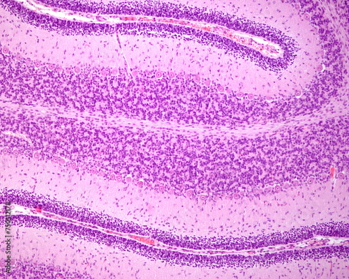 Immature cerebellum. External granular layer photo