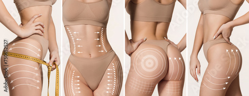 Banner. White lines on slim female body against white background, Anticellulite, lifting plan. Body positivity. Concept of beauty procedures, cosmetology treatment, massage. Ad photo