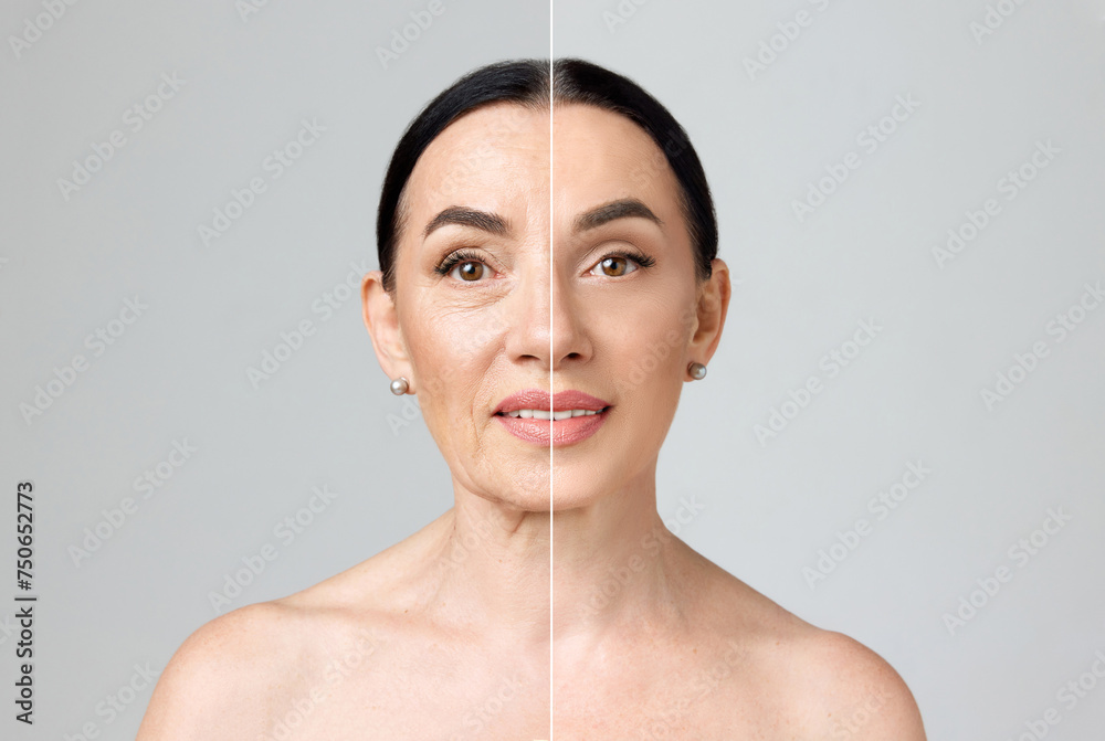 Before-after collage of mature woman showing aging signs and soft, smooth skin after facial care procedures against grey studio background. Concept of beauty, cosmetology treatment, massage. Ad Before-after collage of mature woman showing aging signs and soft, smooth skin after facial care procedures against grey studio background. Concept of beauty, cosmetology treatment, massage. Ad