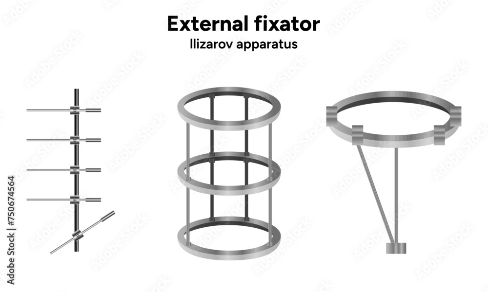 External fixator, llizarov apparatus 