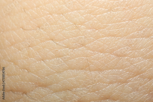 Wallpaper Mural Texture of dry skin as background, macro view Torontodigital.ca