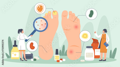 Podiatry concept. Nail and foot disease, medical treatment. Tiny doctors or scientists looking on feet with problems, snugly diagnosis vector scene