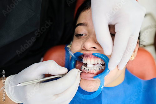 Close up of a dental procedure