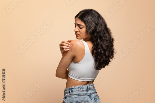 Annoyed young indian woman scratching her irritated body skin