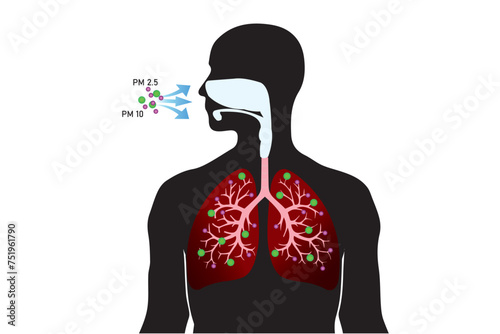 Breathing unhealthy levels of pollution from fine particulates (PM2.5) can increase the risk of health problems like heart disease, asthma, and low birth weight.