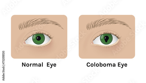 Realistic human normal eyes and with colomba vector illustration design.