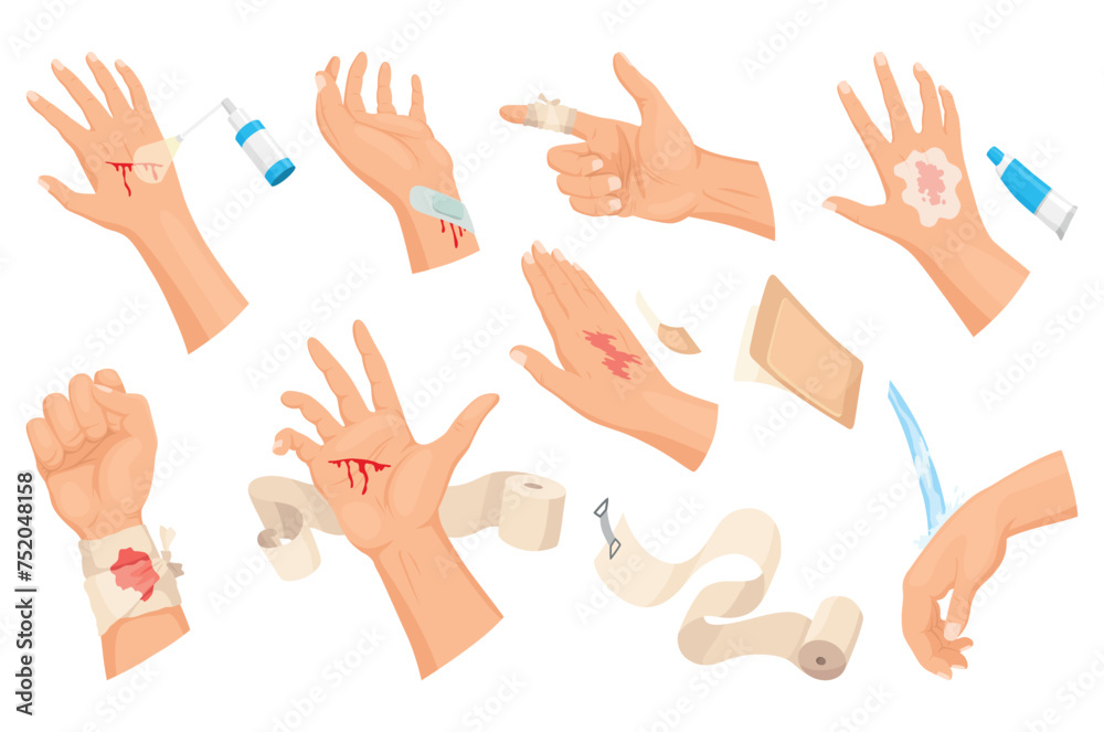 Hands injured skin and procedures of bandaging and wound cleaning. First aid for wound. Medicine cure or treatment. First emergency help for human hand trauma