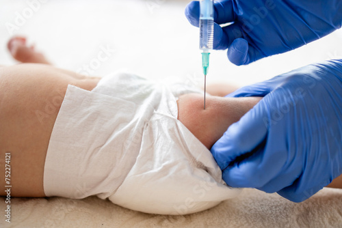 Canvastavla Close up view of syringe needle injecting vaccine into baby leg.