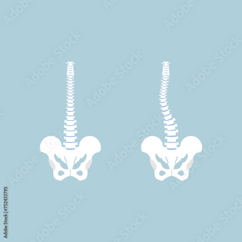 anatomy of human spine, spinal cord, scoliosis, internal organs body part orthopedic health care, vector illustration cartoon flat character design clip art isolated