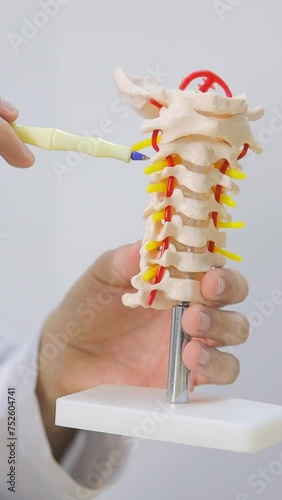 The model of the spine in the doctor's hands. Vertical video photo