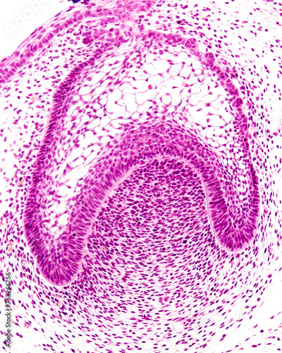 Developing tooth. Bell stage photo