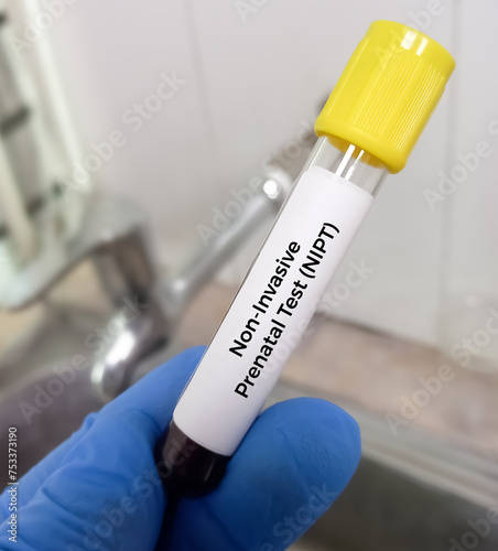 Blood sample for Fetal RHD Screening test for pregnant women. Down syndrome. Disorder of the chromosomes. photo