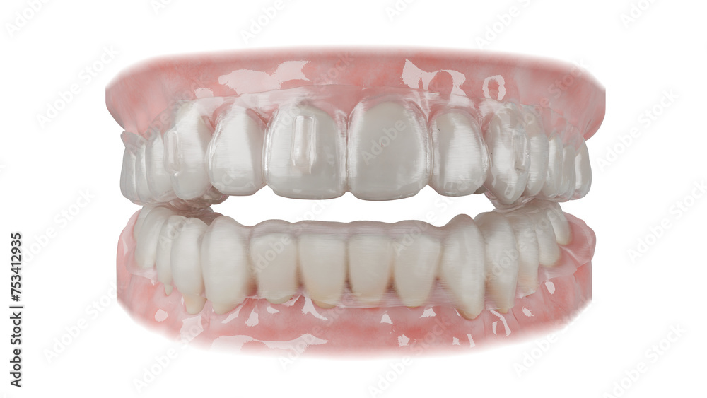 Obraz premium Dental orthodontic clear aligner