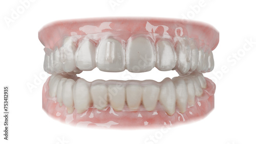 Dental orthodontic clear aligner photo