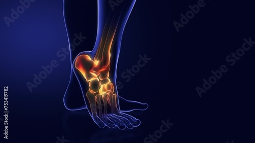 Medical animation for ankle pain photo
